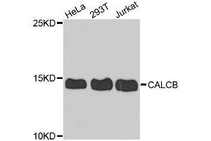 Western blot analysis of extract of various cells, using CALCB antibody. (CALCB anticorps)