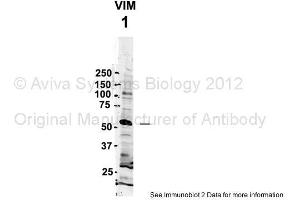 Sample Type: 1. (Vimentin anticorps  (C-Term))