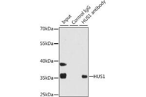 Immunoprecipitation analysis of 200 μg extracts of 293T cells using 1 μg HUS1 antibody (ABIN6131777, ABIN6142085, ABIN6142087 and ABIN6221056).