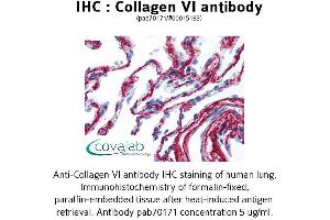 anti-Collagen, Type VI (COL6) antibody