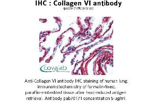 Image no. 1 for anti-Collagen, Type VI (COL6) antibody (ABIN1733229) (COL6 anticorps)