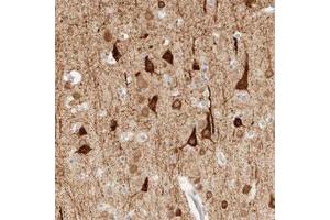 Immunohistochemical staining (Formalin-fixed paraffin-embedded sections) of human cerebral cortex with TNK1 polyclonal antibody  shows strong cytoplasmic positivity in neuronal cells at 1:20-1:50 dilution. (TNK1 anticorps)