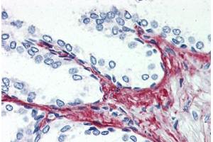 Anti-P2RX3 / P2X3 antibody  ABIN1049196 IHC staining of human prostate.