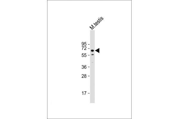 TOR1AIP1 anticorps  (AA 42-76)