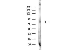 Western blot analysis of lysates from Mouse liver, using Syntrophin alpha 1 Antibody at 1/1000 dilution.