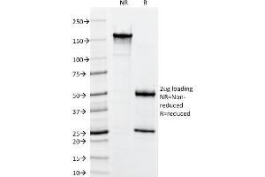 SDS-PAGE Analysis Purified Cytokeratin, HMW Mouse Monoclonal Antibody (34BE12).