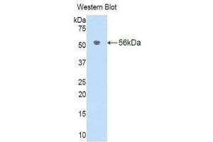 Western Blotting (WB) image for anti-Interleukin 18 Binding Protein (IL18BP) (AA 29-193) antibody (ABIN1176682) (IL18BP anticorps  (AA 29-193))