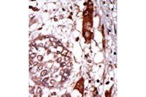 Image no. 2 for anti-Guanine Nucleotide Binding Protein (G Protein), beta Polypeptide 2-Like 1 (GNB2L1) (N-Term) antibody (ABIN360524)