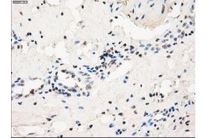 Immunohistochemical staining of paraffin-embedded pancreas tissue using anti-FCGR2A mouse monoclonal antibody. (FCGR2A anticorps)