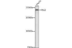 Western blot analysis of extracts of HepG2 cells, using PEG3 antibody (ABIN6128527, ABIN6145434, ABIN6145435 and ABIN6216398) at 1:1000 dilution. (PEG3 anticorps  (AA 1-300))