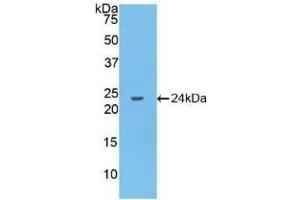 Detection of Recombinant IL10, Human using Polyclonal Antibody to Interleukin 10 (IL10) (IL-10 anticorps  (AA 1-178))