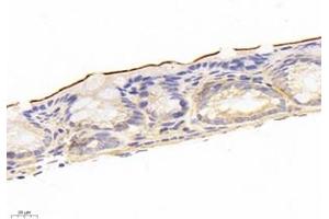 Immunohistochemistry analysis of paraffin-embedded mouse colon using,NHE-3 (ABIN7075685) at dilution of 1: 1200 (SLC9A3 anticorps)