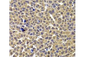 Immunohistochemistry of paraffin-embedded Mouse lung cancer using ARID3A Polyclonal Antibody at dilution of 1:100 (40x lens). (ARID3A anticorps)