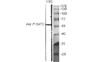 Western Blot analysis of various cells using Phospho-Akt (S473) Polyclonal Antibody diluted at 1:2000.