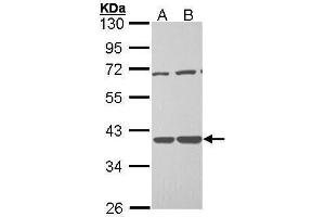 WB Image Sample (30 ug of whole cell lysate) A: H1299 B: Hela 10% SDS PAGE antibody diluted at 1:1000 (TSTA3 anticorps  (C-Term))