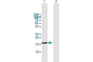 Western Blot analysis of DUSP22 expression in transfected 293T cell line by DUSP22 MaxPab polyclonal antibody. (DUSP22 anticorps  (AA 1-184))