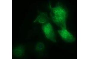 Image no. 2 for anti-Musashi Homolog 1 (Drosophila) (MSI1) antibody (ABIN1499574) (MSI1 anticorps)