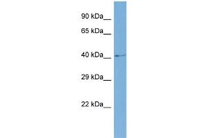 Host:  Rabbit  Target Name:  SLC6A5  Sample Type:  COLO205 Whole cell lysates  Antibody Dilution:  1. (SLC6A5 anticorps  (N-Term))