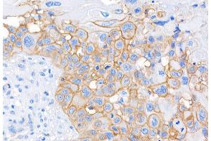 Immunohistochemistry (IHC) image for anti-CD44 (CD44) (AA 692-742) antibody (ABIN7453578)