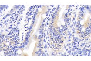 Detection of MUC5B in Human Small intestine Tissue using Polyclonal Antibody to Mucin 5 Subtype B (MUC5B) (MUC5B anticorps  (AA 5366-5444))