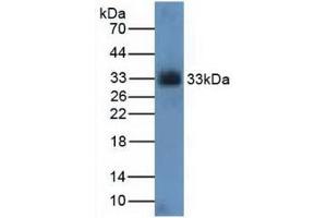 Figure. (CDK4 anticorps  (AA 6-295))