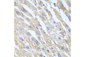 Immunohistochemistry of paraffin-embedded human liver using PPP4R1 antibody. (PPP4R1 anticorps  (AA 324-647))