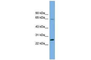 WB Suggested Anti-DHFRL1 Antibody Titration: 0. (DHFRL1 anticorps  (Middle Region))