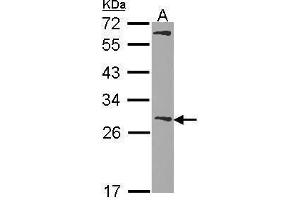 WB Image Sample (30 ug of whole cell lysate) A: Hela 12% SDS PAGE Glutathione S-transferase Mu 1 antibody antibody diluted at 1:1000 (GSTM1 anticorps  (C-Term))