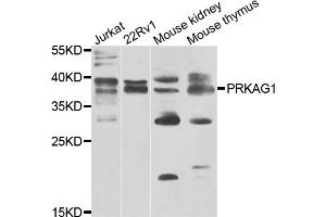 Western blot analysis of extracts of various cell lines, using PRKAG1 antibody. (PRKAG1 anticorps)