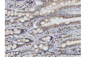 Image no. 1 for anti-Trans-Golgi Network Protein 2 (TGOLN2) (AA 229-328) antibody (ABIN599146) (TGOLN2 anticorps  (AA 229-328))
