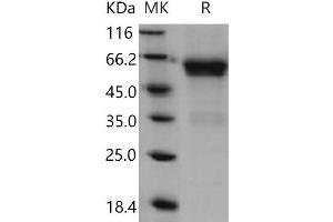 Western Blotting (WB) image for CD27 Molecule (CD27) (Active) protein (His tag,Fc Tag) (ABIN7194768)