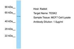 Image no. 1 for anti-Testis-Specific Kinase 2 (TESK2) (C-Term) antibody (ABIN6750038)