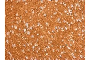 IHC-P Image Amphiphysin antibody [N1N2], N-term detects AMPH protein at cytosol on mouse brain by immunohistochemical analysis. (Amphiphysin anticorps  (N-Term))
