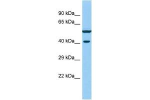 Host: Rabbit Target Name: VWC2 Sample Type: Fetal Liver lysates Antibody Dilution: 1. (VWC2 anticorps  (N-Term))