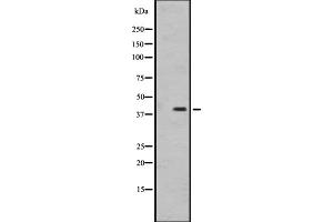 Western blot analysis of OR1I1 expression in MDA-MB231 cell line lysate ,The lane on the left is treated with the antigen-specific peptide. (OR1I1 anticorps  (C-Term))