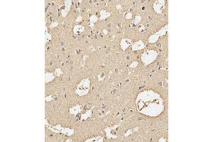 anti-Calmodulin 1 (Calm1) (AA 117-149), (C-Term) antibody