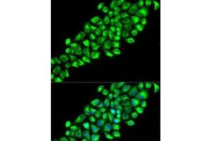 Immunofluorescence analysis of HeLa cells using PON2 Polyclonal Antibody (PON2 anticorps)