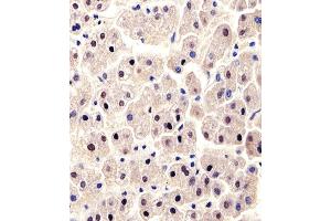 Immunohistochemical analysis of paraffin-embedded H. (ALT anticorps  (N-Term))