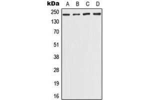 Western blot analysis of CHD5 expression in Hela (A), HepG2 (B), NIH3T3 (C), rat brain (D) whole cell lysates. (CHD5 anticorps  (Center))