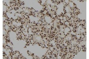 ABIN6278515 at 1/100 staining Rat lung tissue by IHC-P. (RFC3 anticorps  (N-Term))