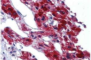 Adrenal, Human: Formalin-Fixed, Paraffin-Embedded (FFPE)