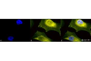 Immunocytochemistry/Immunofluorescence analysis using Rabbit Anti-SOD1 (UBB) Polyclonal Antibody . (SOD1 anticorps  (N-Term) (PerCP))