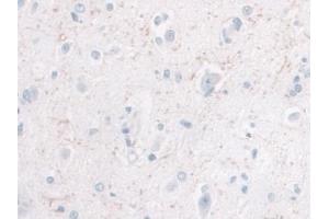 anti-Interleukin 10 (IL10) (AA 1-178) antibody