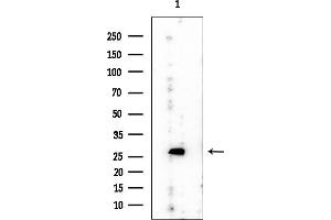Western blot analysis of lysates from Rat brain, using ZFAND3 Mouse Monoclonal Antibody at 1/1000 dilution.