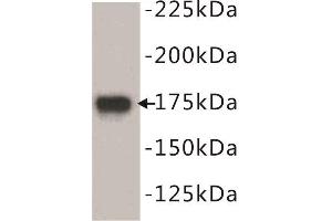 Western Blotting (WB) image for anti-Epidermal Growth Factor Receptor (EGFR) (N-Term) antibody (ABIN1854890) (EGFR anticorps  (N-Term))