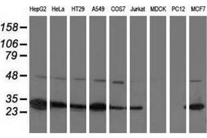 Western blot analysis of extracts (35 µg) from 9 different cell lines by using anti-SPR monoclonal antibody. (SPR anticorps)