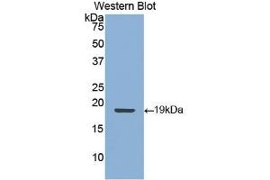 Detection of Recombinant KRT9, Human using Polyclonal Antibody to Cytokeratin 9 (CK9) (KRT9 anticorps  (AA 315-456))