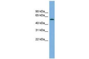 Image no. 1 for anti-Glucocorticoid Induced Transcript 1 (GLCCI1) (AA 179-228) antibody (ABIN6744984) (GLCCI1 anticorps  (AA 179-228))