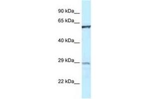 Image no. 1 for anti-Protein-tyrosine Phosphatase 1C (PTPN6) (AA 245-294) antibody (ABIN6747490) (SHP1 anticorps  (AA 245-294))