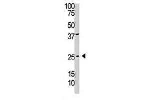 The PDGFB polyclonal antibody  is used in Western blot to detect PDGFC in A-375 cell lysate. (PDGFB anticorps  (C-Term))
